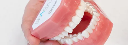 Spark™ Aligners on a dental model